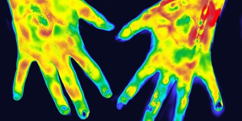 Os Benefícios da Termografia na Saúde e no Diagnóstico Médico